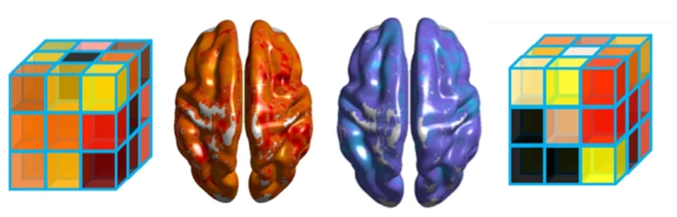 The role of the anterior temporal cortex in action